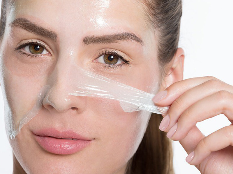 Kimyasal Peeling